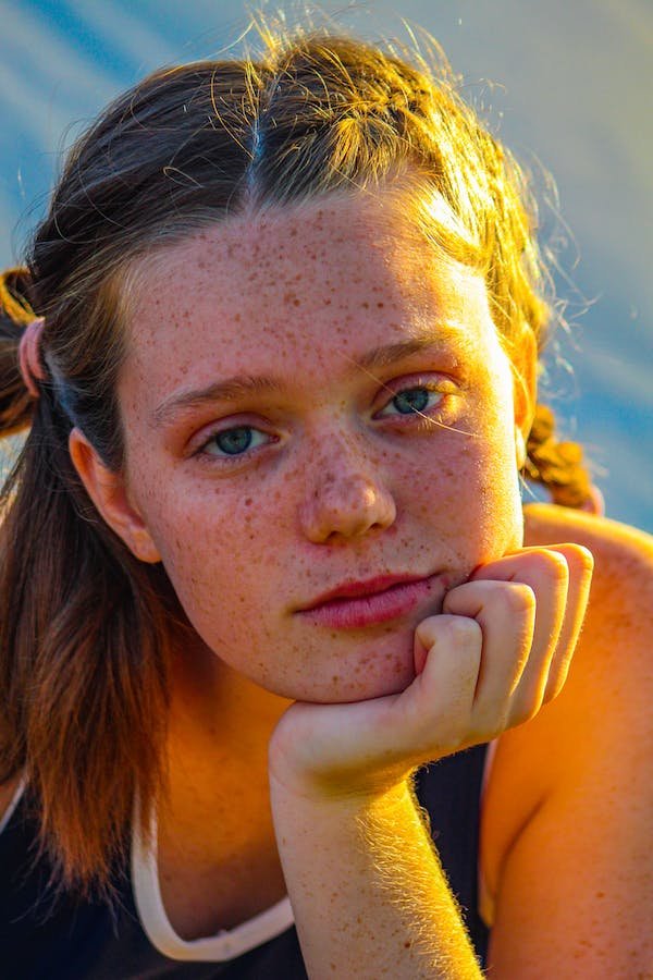 Impact of Freckles on Face