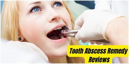 User-Friendly Tooth Abscess Solutions Reviewed