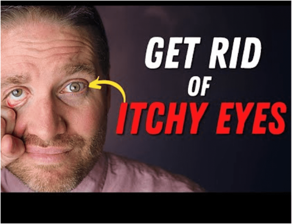 Best Eye Drops for Itching - Expert Reviews