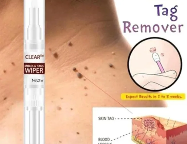Customer Testimonials for Wipeoff Tags & Moles Remover