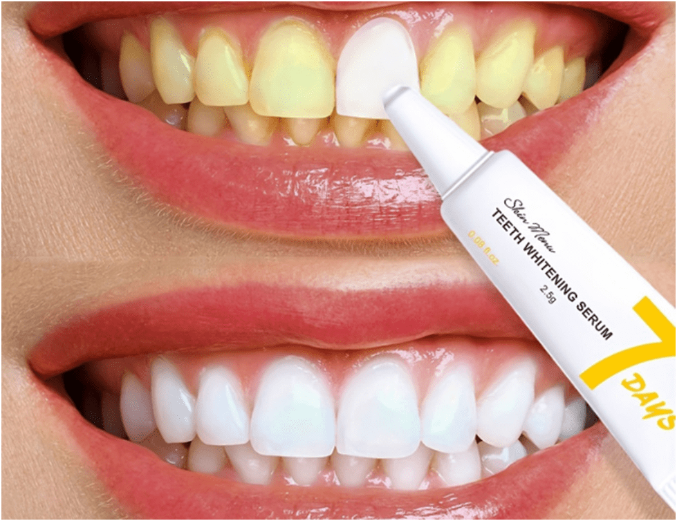 Teeth Whitening Serum