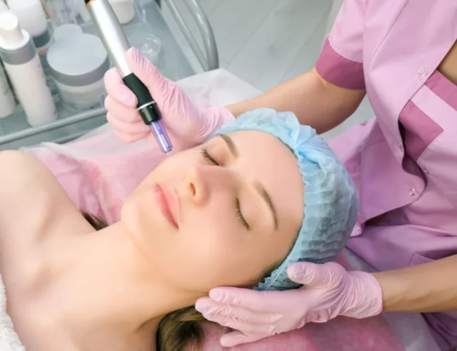 Impact of Microneedling Before and After