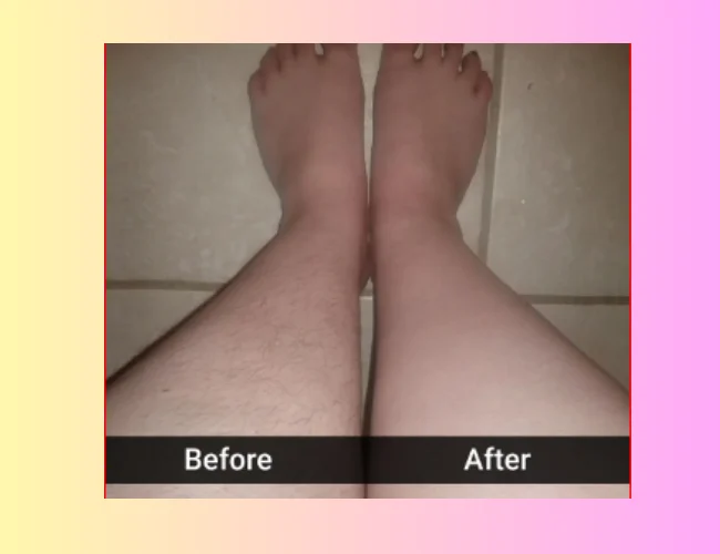 Before and after use of 5minskin 