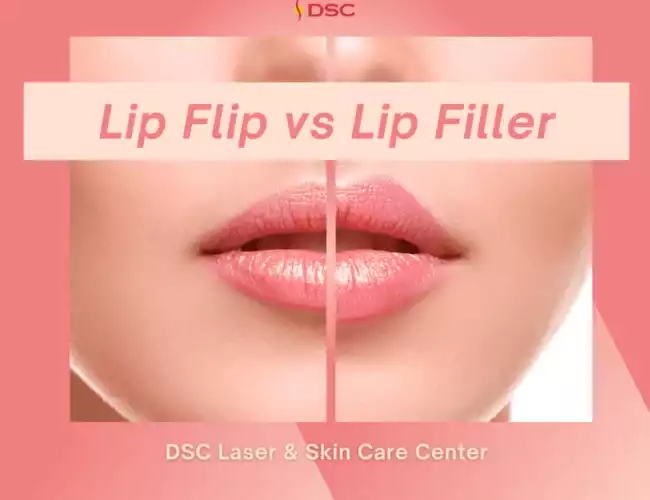 Lips filler vs Lip filler