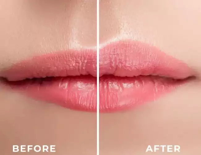 Lip beauty 