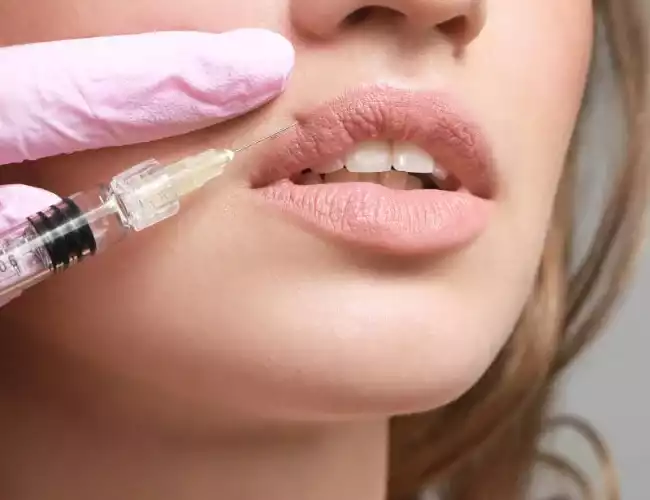 Treatment of lip filler