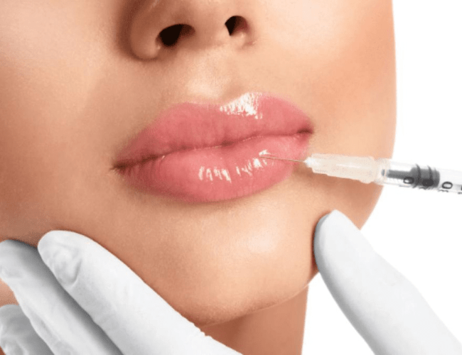 Post Lip Filler Care