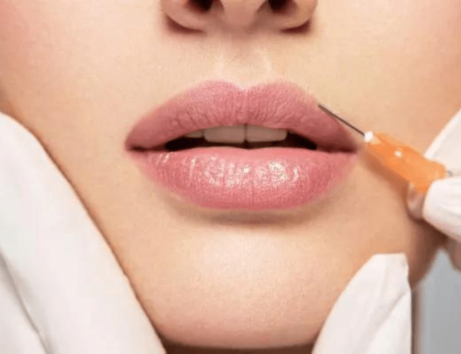 Post Lip Filler Care